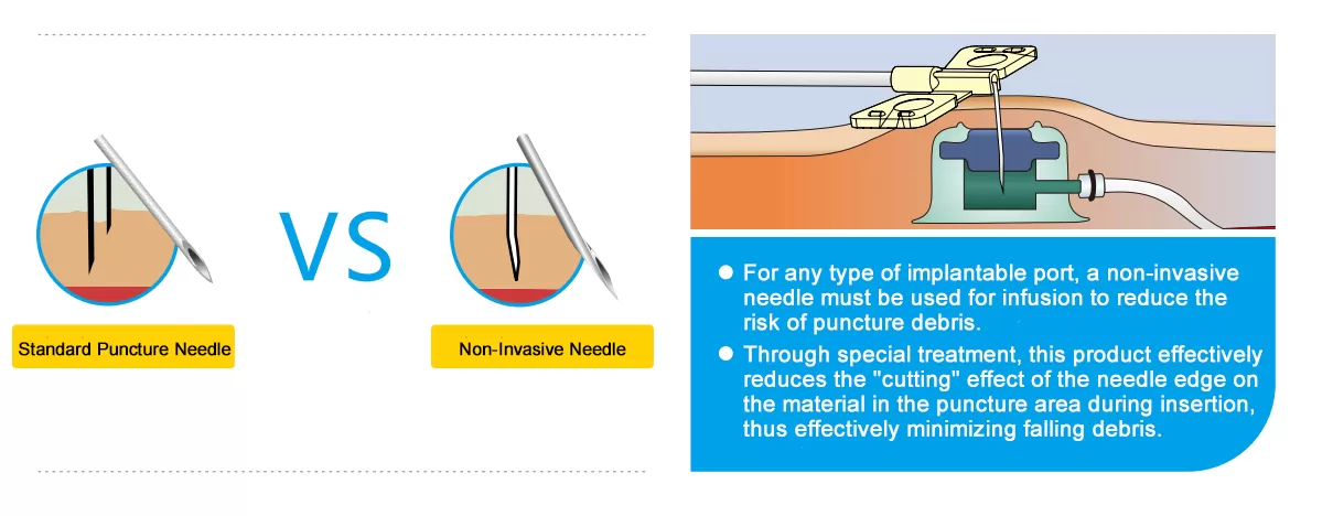 SINGLE-USE HUBER NEEDLES USED FOR IMPLANTABLE DRUG-SUPPLYING DEVICES 51.jpg