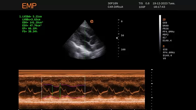 Diagnostic Ultrasound System 5.png