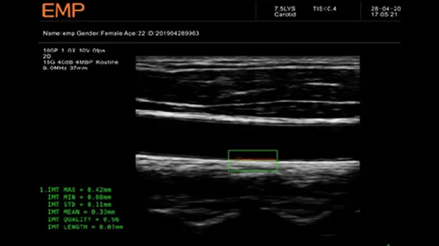 Diagnostic Ultrasound System 6.png
