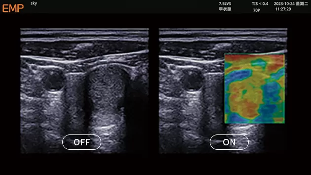 Diagnostic Ultrasound System 7.png