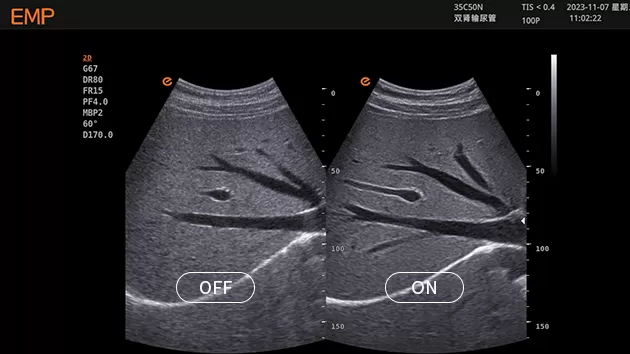 Diagnostic Ultrasound System 9.png