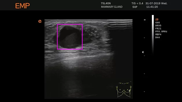Diagnostic Ultrasound System 10.png