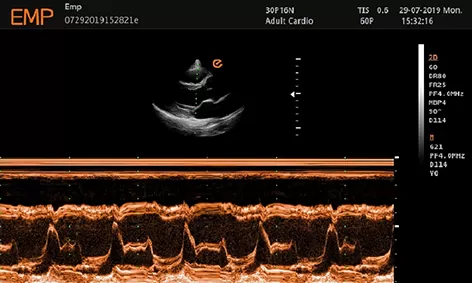 Adult Cardiology